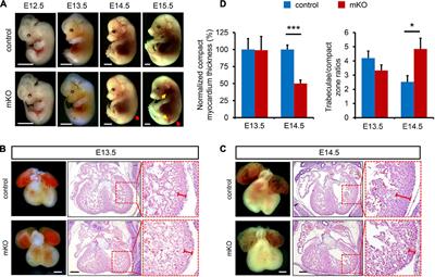 Histone Lysine Methyltransferase SETD2 Regulates Coronary Vascular Development in Embryonic Mouse Hearts